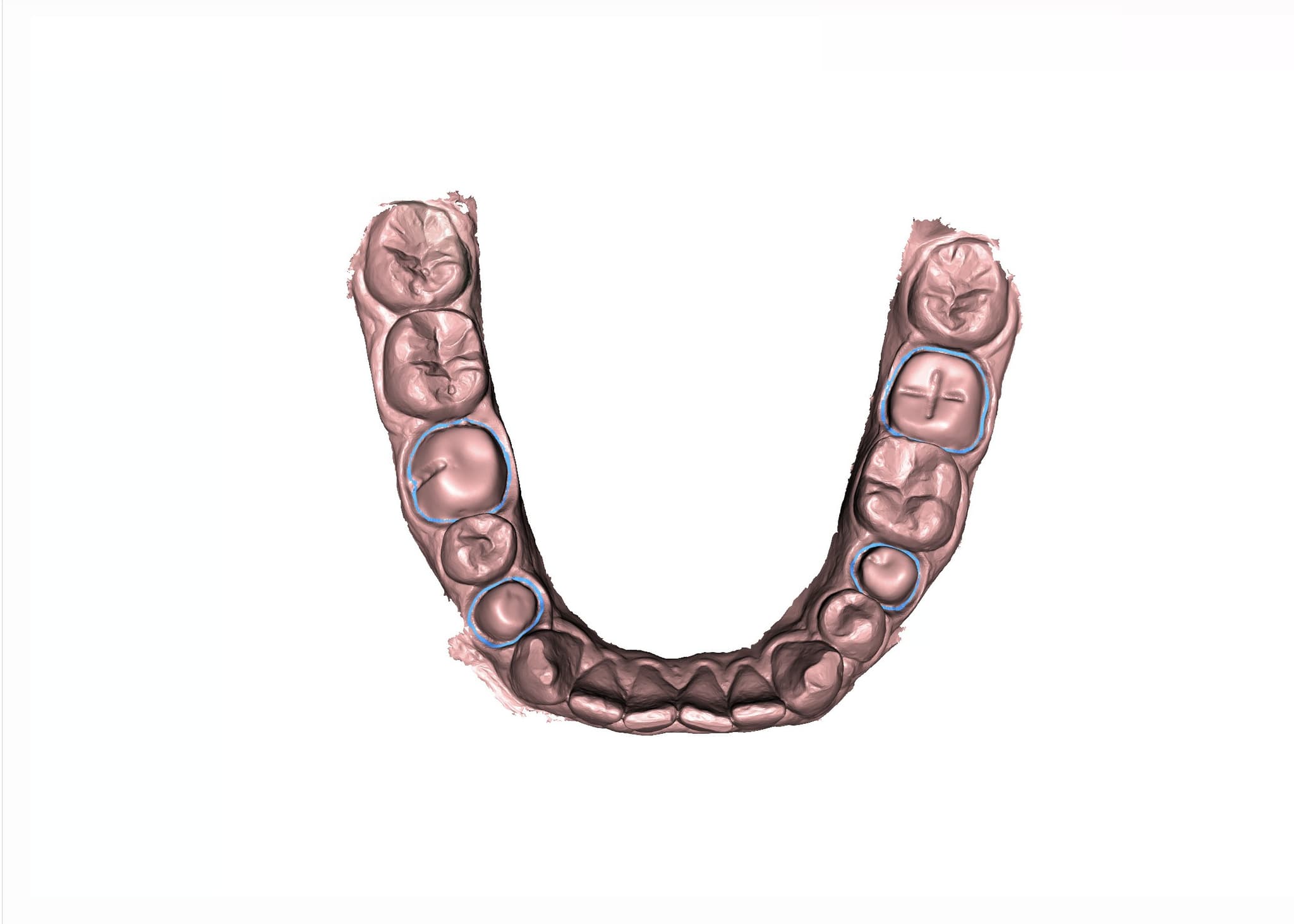 Dental AI